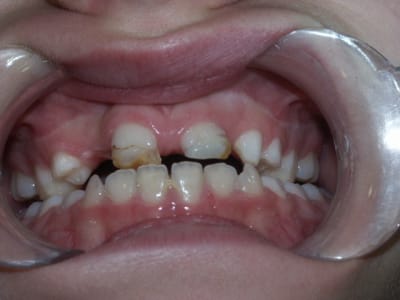 Pict0172 z68yzm - Eugenol