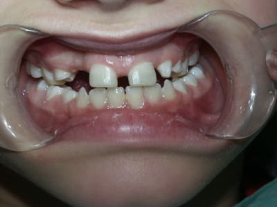 Pict0175 xoxbjw - Eugenol