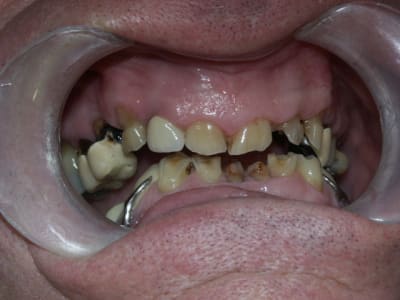 Pict0204 vrrzcs - Eugenol