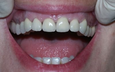 Pict0378 t1wtpj - Eugenol