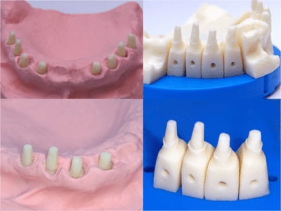 Positdental urjwz6 - Eugenol