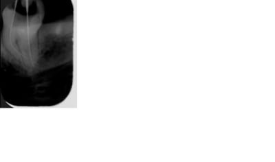 Pac 2 uwbnkl - Eugenol