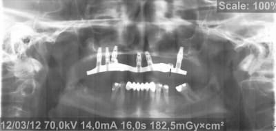 Pano 2 h2rj1y - Eugenol