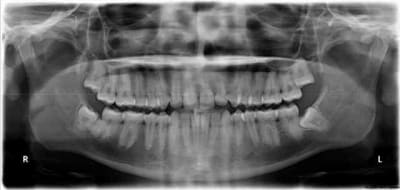Pano ohuyqs - Eugenol