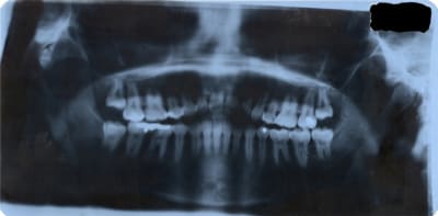 Panoramique1 wjl3pd - Eugenol