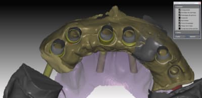 Pemergence tbkryk - Eugenol