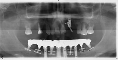 Pepe bimf8x - Eugenol
