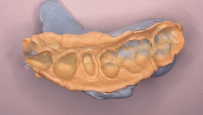 Perfectim 01 wfmpob - Eugenol