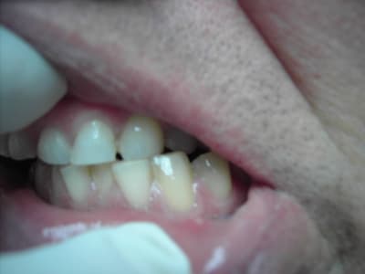 Photo 013 kjyvee - Eugenol