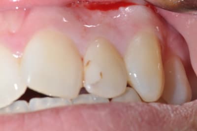 Photo 015 hm6z8r - Eugenol