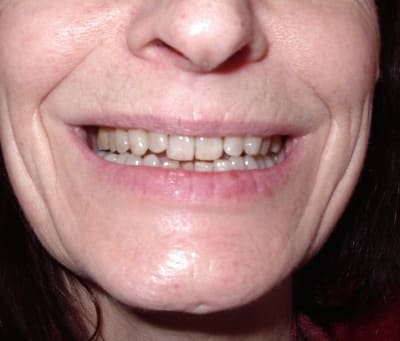 Photo 068 z7vjhn - Eugenol