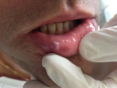 Photo 2013 05 02 12.24 - Eugenol