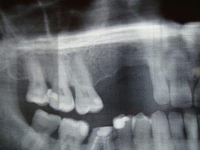 Photo sony 2262 uuezig - Eugenol