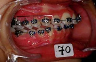 Picture1 pvviml - Eugenol