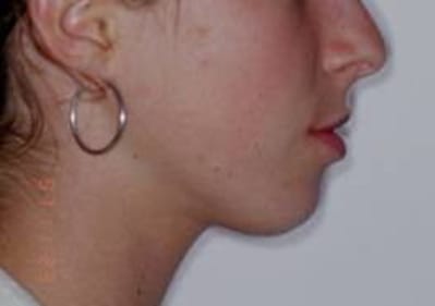 Picture2 c jqxw3l - Eugenol