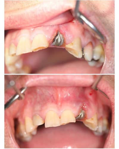 Planche contact 001 copie khm8xb - Eugenol