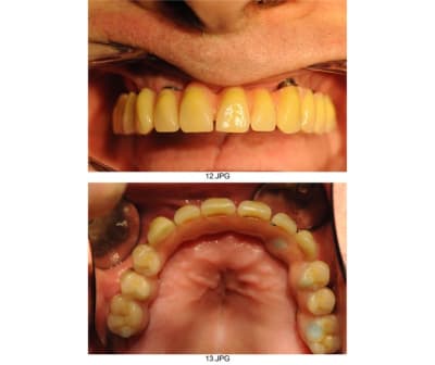 Planche contact 006 tuk35j - Eugenol