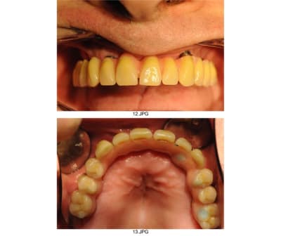 Planche contact 006 tuk35j - Eugenol