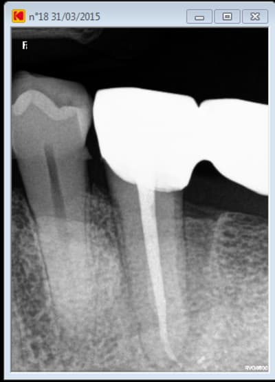 Poche paro u4fh5j - Eugenol