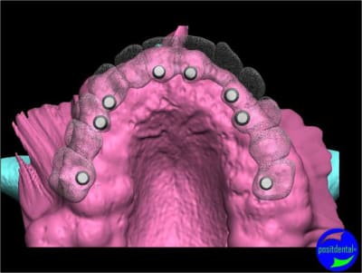 Positdental 009 anul8c - Eugenol