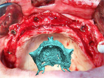 Positguide 3 tsce8v - Eugenol