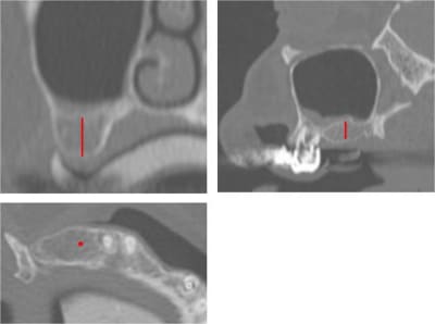 Positguide 4 r45b7t - Eugenol