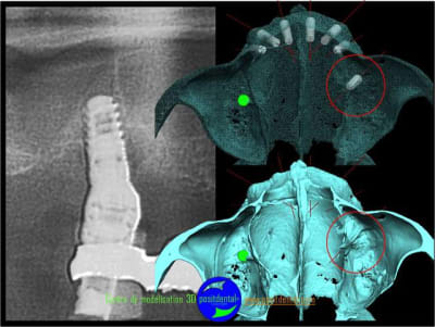 Positguide 8 fvmogc - Eugenol