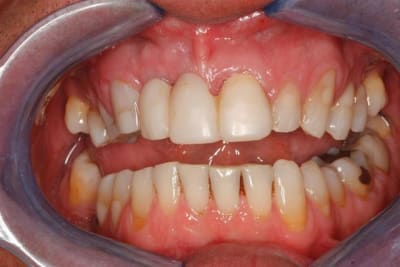Pr  op hvqq8i - Eugenol