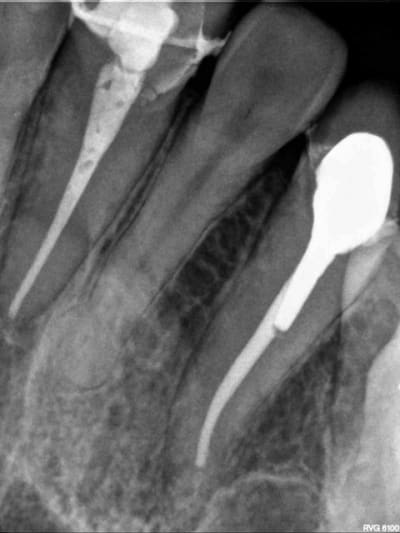 R11 c2evfh - Eugenol