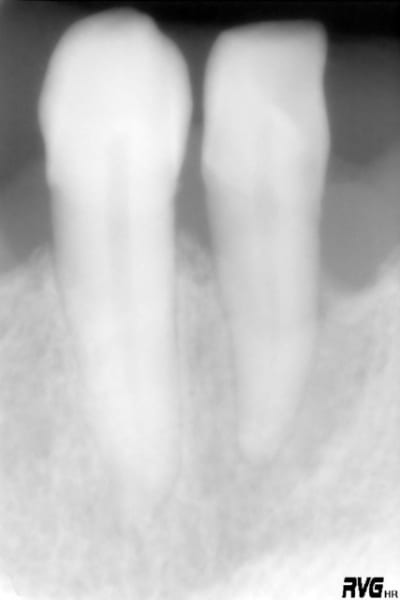 R11 xacjnq - Eugenol