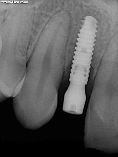 R12 kfzljk - Eugenol