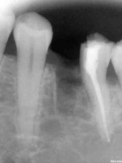 R14 cyiqmo - Eugenol
