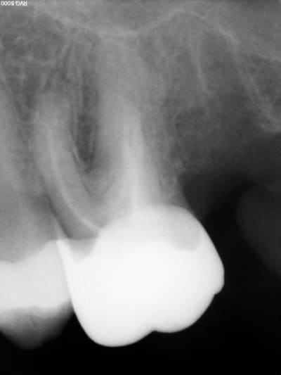 R16 n4b2d5 - Eugenol