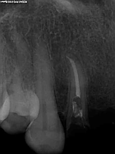 R17 rp0zpr - Eugenol