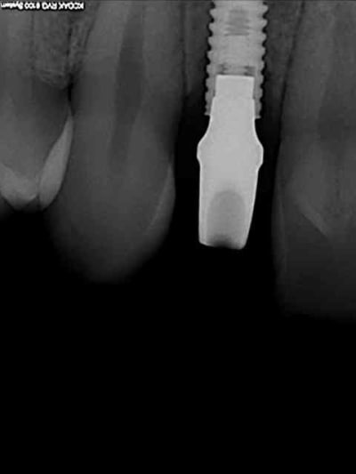 R18 hlvebj - Eugenol
