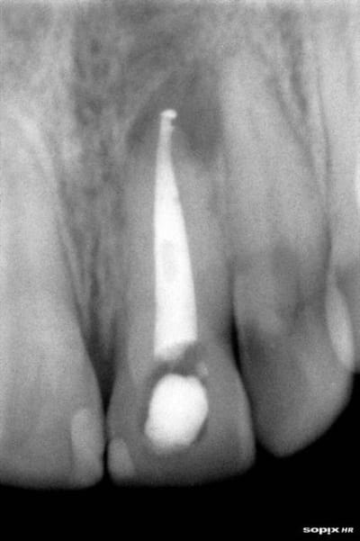 R2à1mois u9popi - Eugenol