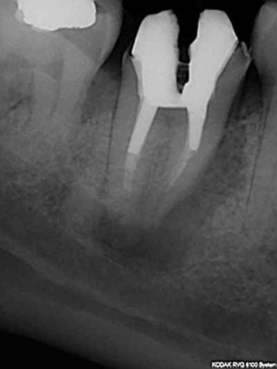 R23 wggrtf - Eugenol