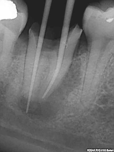R24 rg4pkr - Eugenol