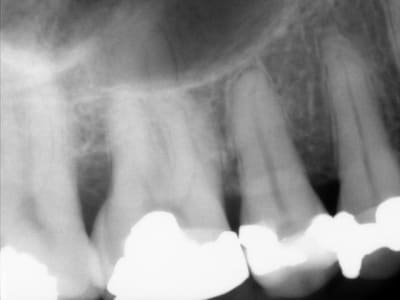 R2bis duvnj3 - Eugenol