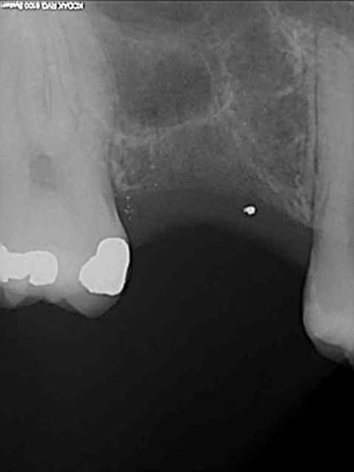 R4 tnibxe - Eugenol