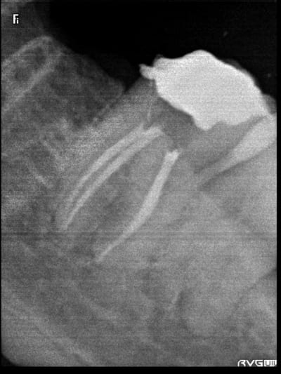 R6 pdwrxu - Eugenol