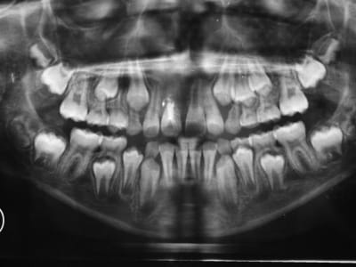 Radio 28 aout 2007  medium  aeayfe - Eugenol