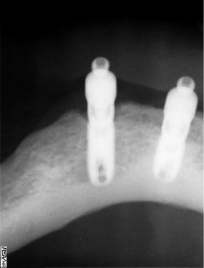 Ra  3  bonqhm - Eugenol