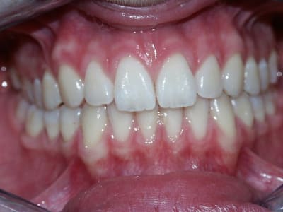 Rim ozybtq - Eugenol