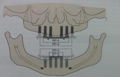 Rp4 5 ogpwg6 - Eugenol