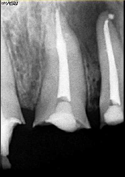 Rx1 jnnohi - Eugenol