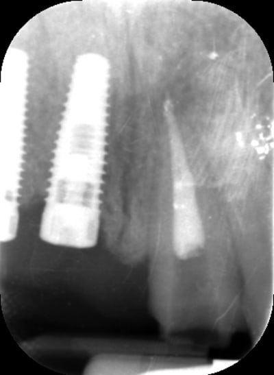 Rx21 kdw5wq - Eugenol
