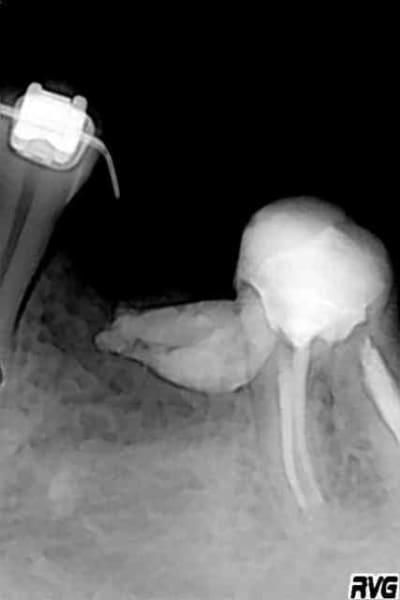 Radio1 hsdl9a - Eugenol