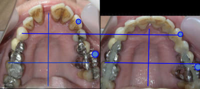 Recul bascule ycjorb - Eugenol