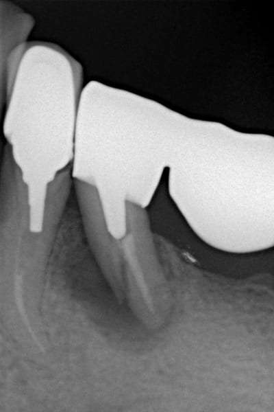 Santin a 19430110 59764536 2 vwwqtl - Eugenol